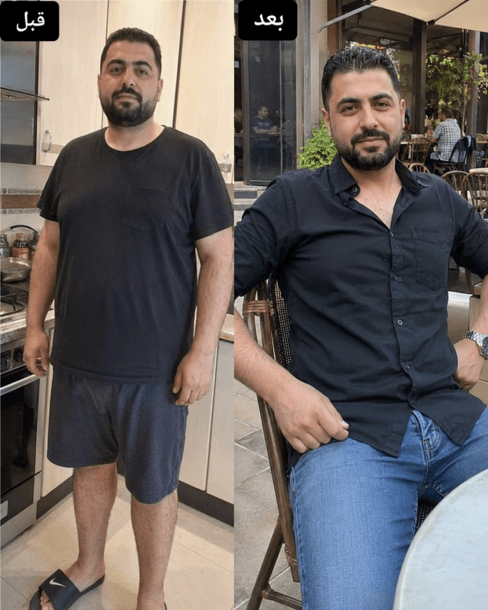نتيجة عميل قبل وبعد Herbal Slim Coffee