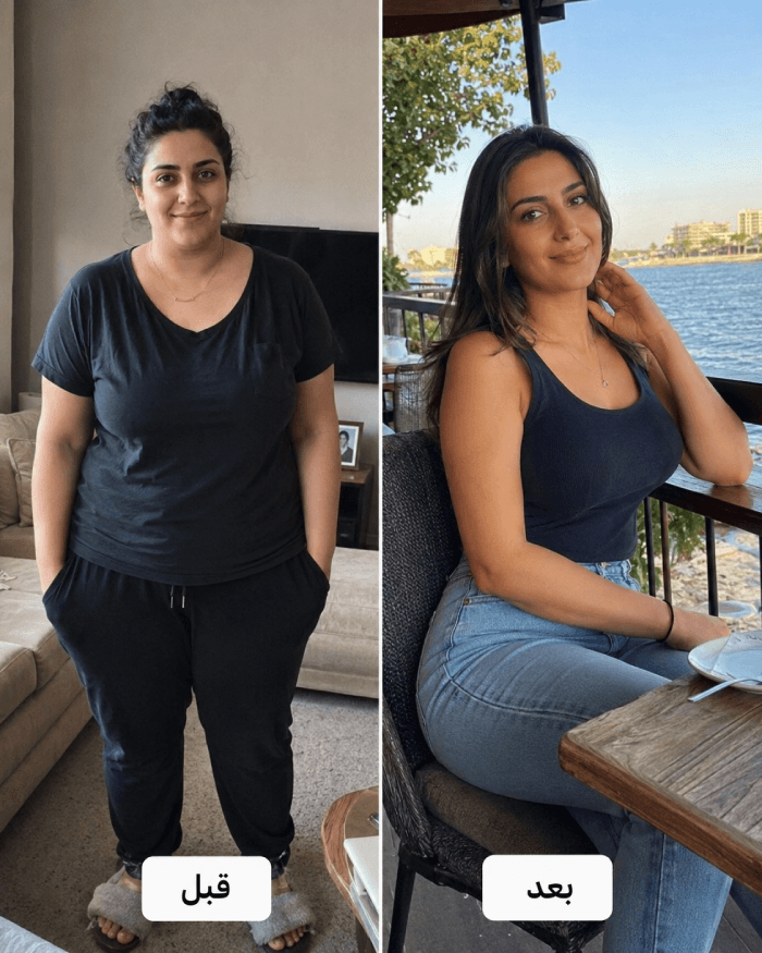 نتيجة عميل قبل وبعد Herbal Slim Coffee