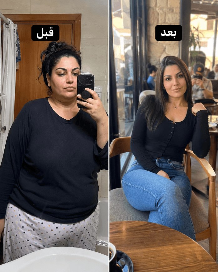 نتيجة عميل قبل وبعد Herbal Slim Coffee