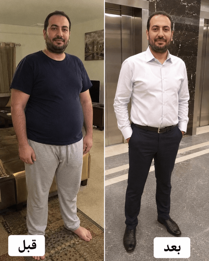 نتيجة عميل قبل وبعد Herbal Slim Coffee