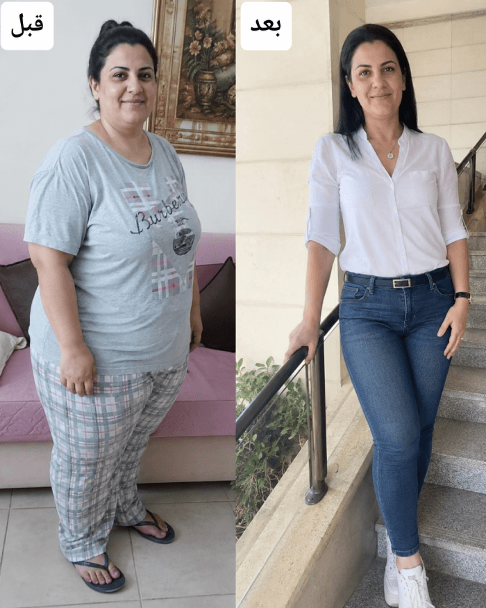 نتيجة عميل قبل وبعد Herbal Slim Coffee