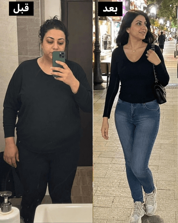 نتيجة عميل قبل وبعد Herbal Slim Coffee