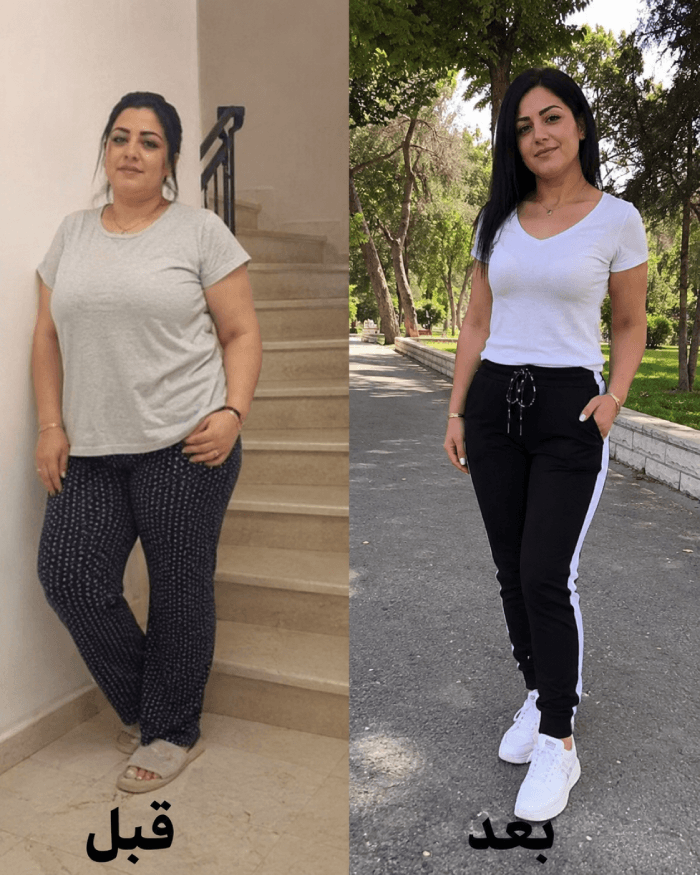 نتيجة عميل قبل وبعد Herbal Slim Coffee